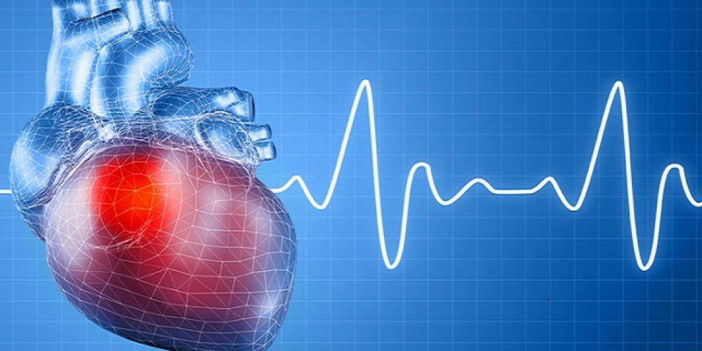 Как регистр РЕКВАЗА помогает кардиологическим больным